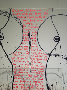 $exhibit.imageAltText5
